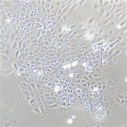 SCaBERSCaBER 人膀胱鳞癌细胞