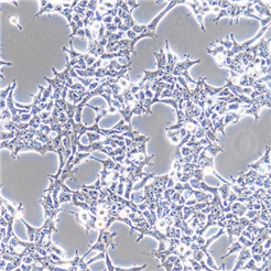 HSF细胞   人真皮成纤维细胞永生化